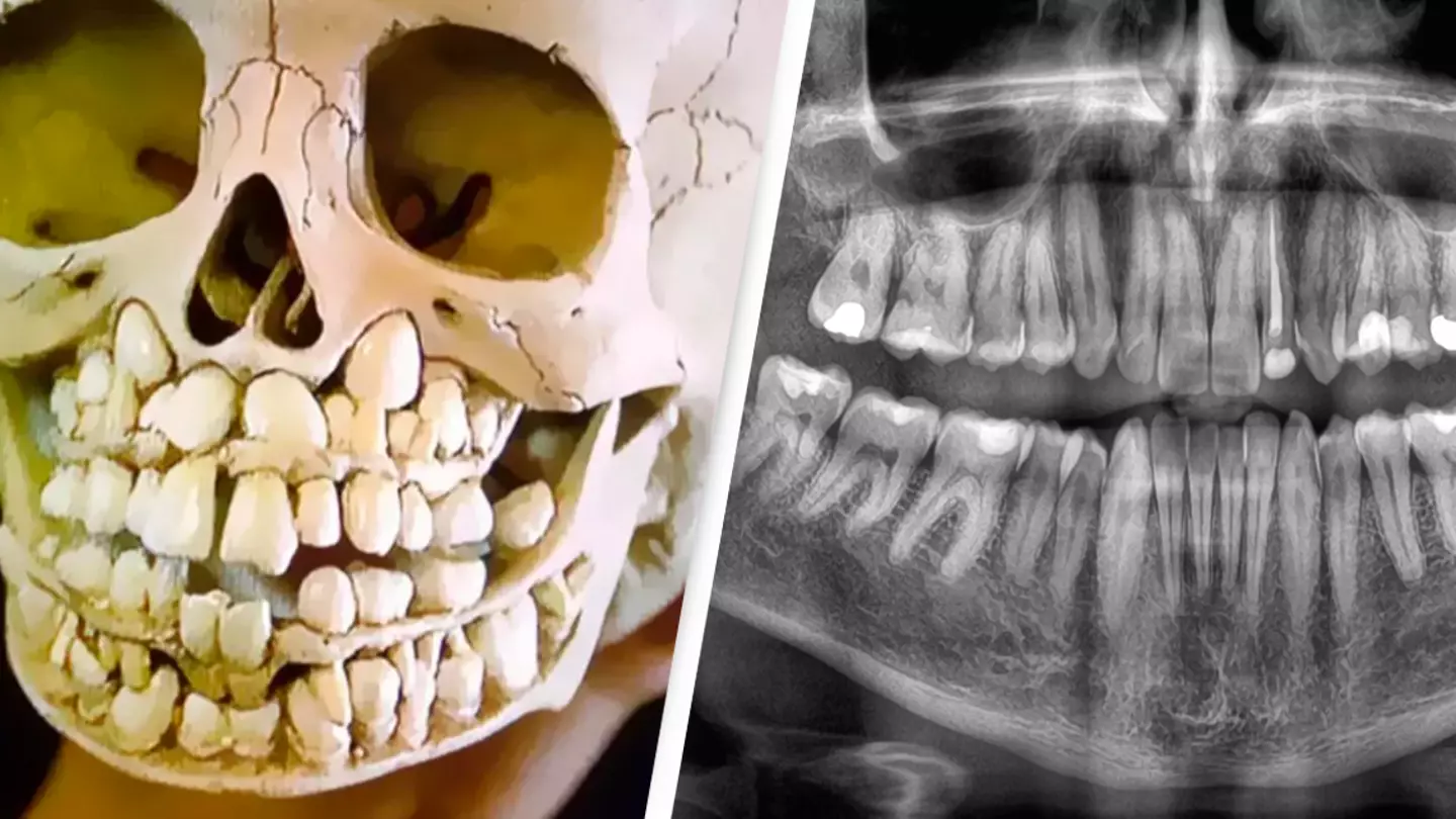 People Terrified After Seeing What a Child’s Skull Looks Like